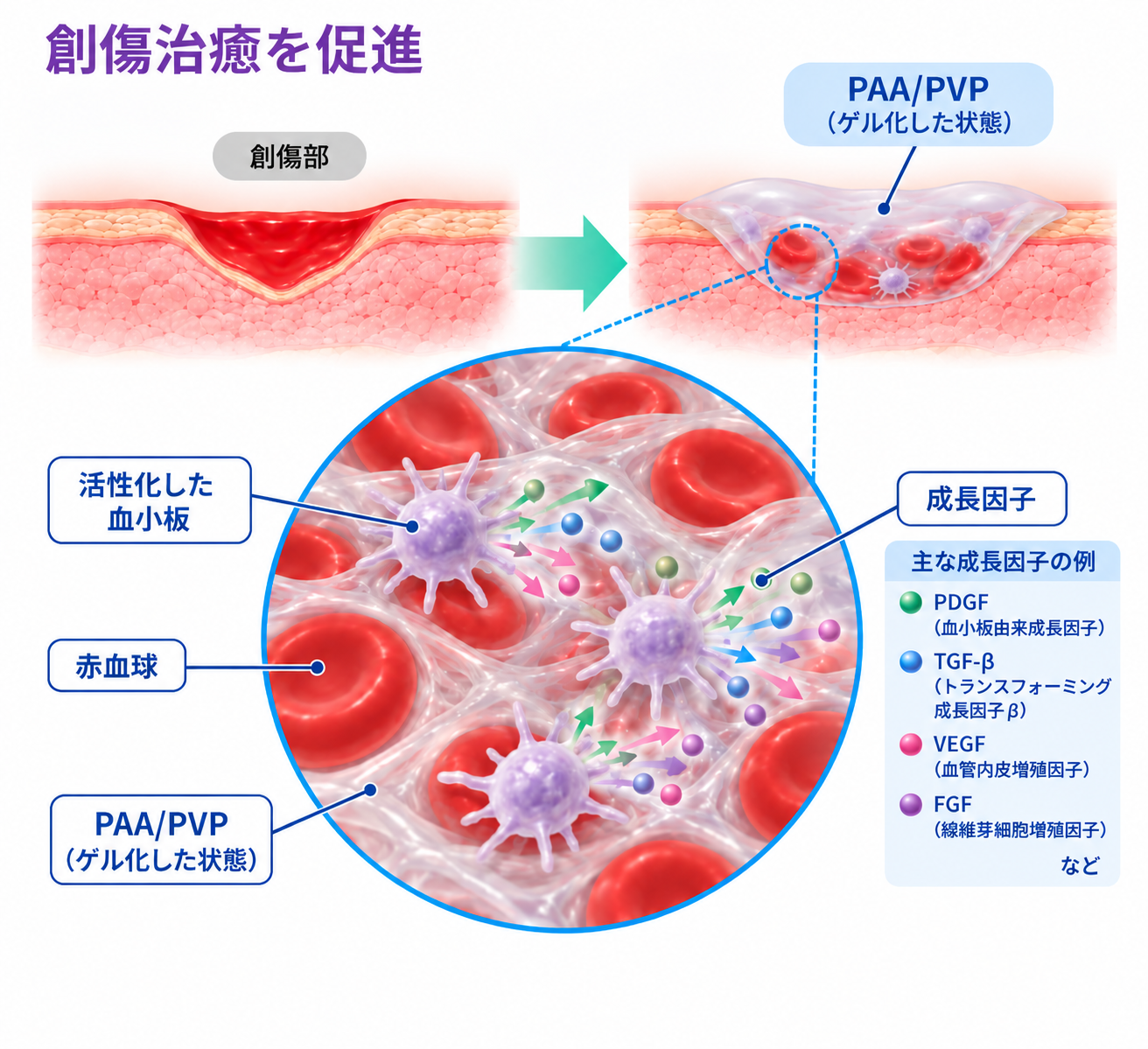PAA/PVP複合体による創傷治癒促進の模式図